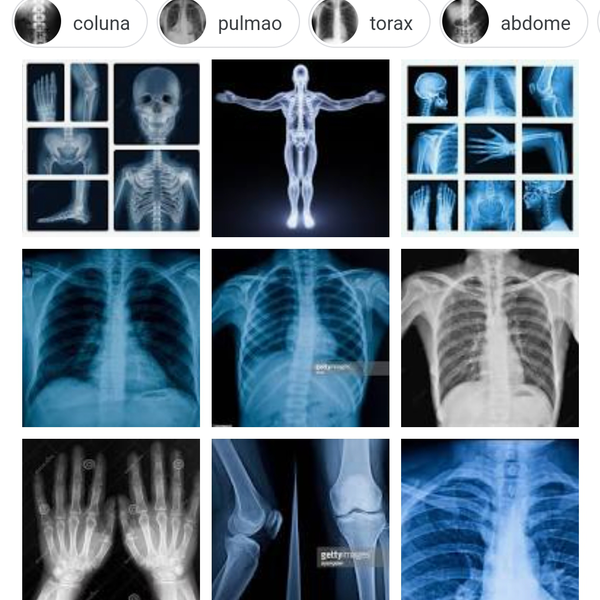 Compro capinha de cds  - outros - São Paulo, SP - B2Blue - Compra e Venda de Resíduos